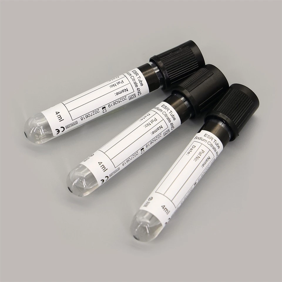 3.2% / 3.8% Sodium Citrate ESR Vacuum Blood Collection Tube 4:1 factory